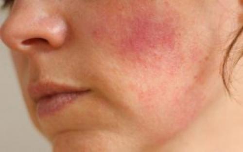 Маска для лица из нектарина. Косметические маски на основе персика для лица