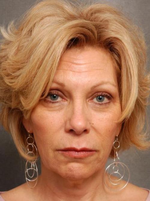 Какой крем от морщин выбрать. Крем от морщин 17 Какой крем от морщин выбрать. Крем от морщин 17