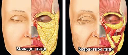 Темные круги под глазами причины. Возрастные изменения и темные круги под глазами