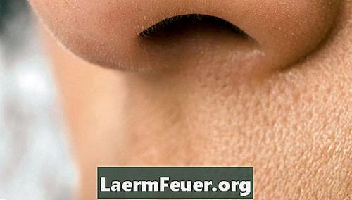 При надавливании на нос из пор выходит белый гной жир. Виды комедонов 04 При надавливании на нос из пор выходит белый гной жир. Виды комедонов 04