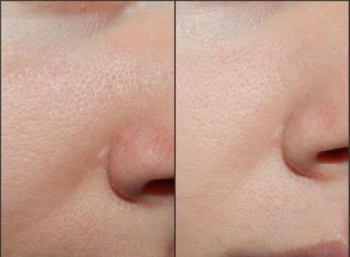 Жирная кожа, какой крем выбрать. Декоративная косметика