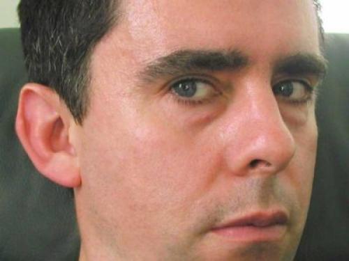 Желтые мешки под глазами у мужчин. Мешки под глазами у мужчин: причины появления и методы лечения