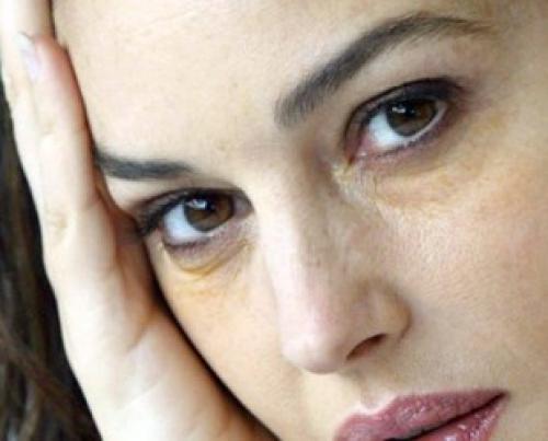 Синева под глазами причины у женщин. Синяки под глазами — причины у женщин 01 Синева под глазами причины у женщин. Синяки под глазами — причины у женщин 01
