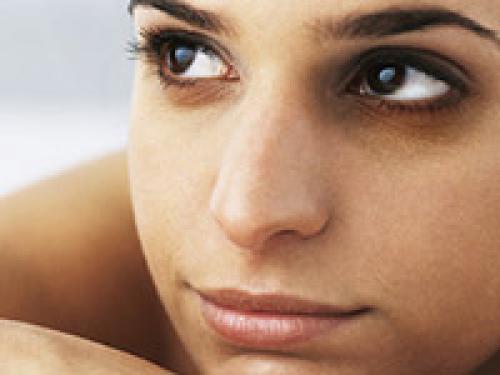 Как убрать черные круги под глазами в домашних условиях. Аллергические реакции 07 Как убрать черные круги под глазами в домашних условиях. Аллергические реакции 07