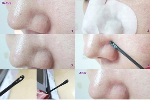 Как очистить черные точки на носу. Как убрать черные точки на носу в домашних условиях — быстро и эффективно 06 Как очистить черные точки на носу. Как убрать черные точки на носу в домашних условиях — быстро и эффективно 06