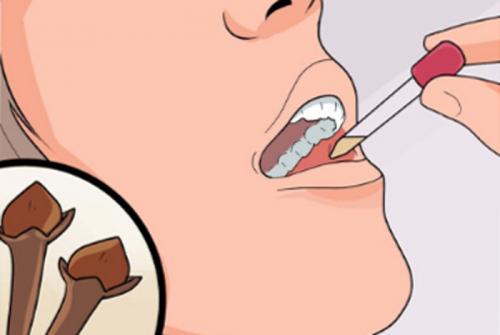 Гвоздика целая от зубной боли. Помогает ли гвоздика от зубной боли