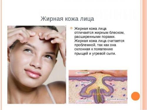Жирная кожа лица. Плюсы и минусы жирной кожи лица