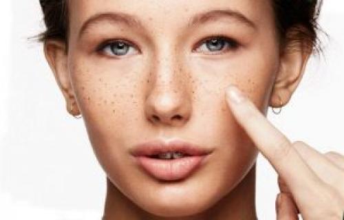 Убрать пигментные пятна перекисью водорода. Рецепты масок