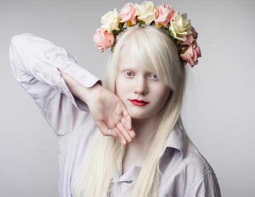 Самое эффективное средство от пигментных пятен на лице. Что такое пигментные пятна?