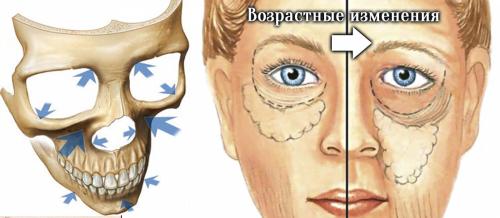 Темные круги под глазами причины. Возрастные изменения и темные круги под глазами