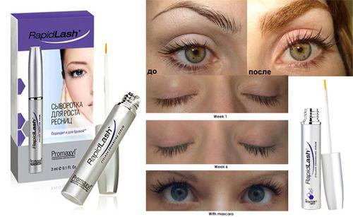 Тушь для ресниц лечебная. Какие средства для роста ресниц в аптеках можно использовать 01 Тушь для ресниц лечебная. Какие средства для роста ресниц в аптеках можно использовать 01