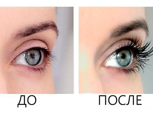 Средство для роста ресниц Алерана. Обзор средства Алерана для роста ресниц