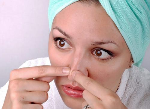 Домашнее средство от черных точек. Методы избавления от черных точек 10 Домашнее средство от черных точек. Методы избавления от черных точек 10