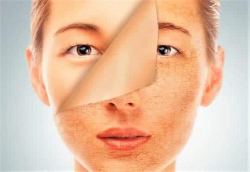 Сухая кожа это. Сухая кожа лица: ищем причину