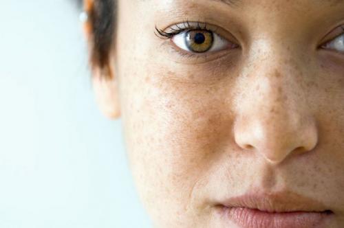 Сухая кожа тела витамины. Чем вызвана сухость кожи