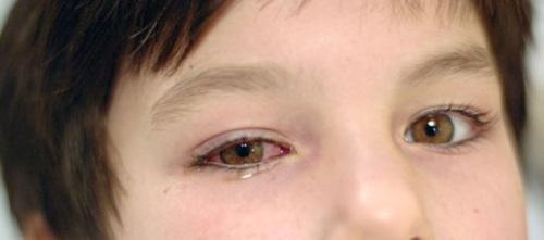 Маска из капусты для лица. Чего ожидать от капустных процедур? 02