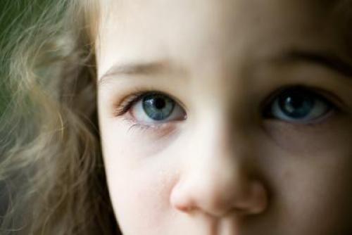 Желтые круги вокруг глаз у женщин причины. Почему появляются 01 Желтые круги вокруг глаз у женщин причины. Почему появляются 01