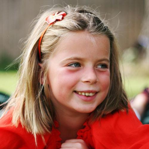 Желтые круги вокруг глаз у женщин причины. Почему появляются 03 Желтые круги вокруг глаз у женщин причины. Почему появляются 03