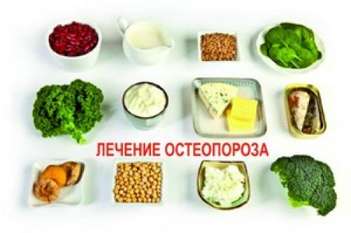 Какие продукты выводят кальций. Причины вымывания кальция из костной ткани 05