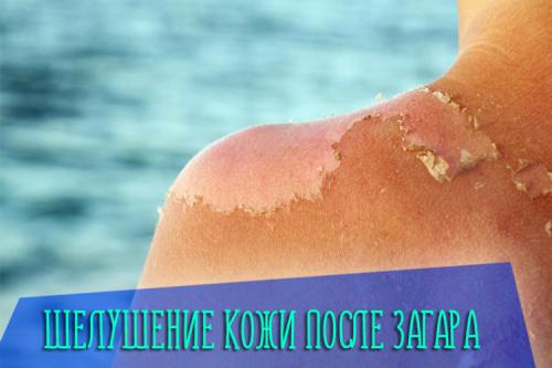 Сухая Кожа и Шелушится после загара. Причины шелушения кожи после загара