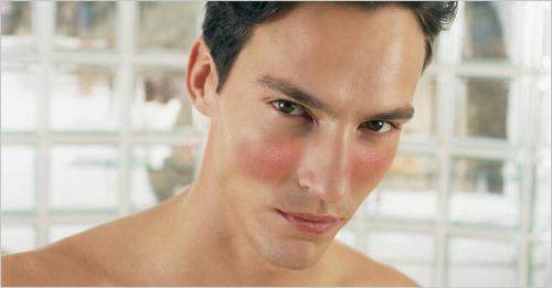 Купероз это. Что предпринять?