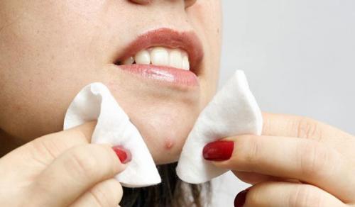 От черных точек народные средства. Используем дегтярное мыло 09 От черных точек народные средства. Используем дегтярное мыло 09