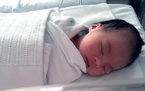 Самая большая черная точка. Разновидности комедонов 04