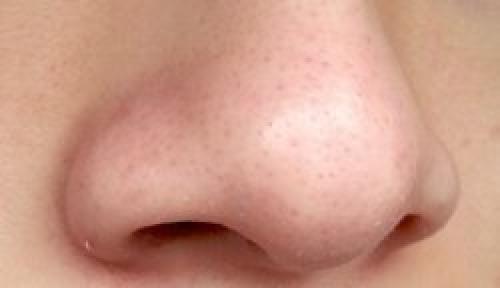 Пористая кожа на лице. Хлебная маска 05