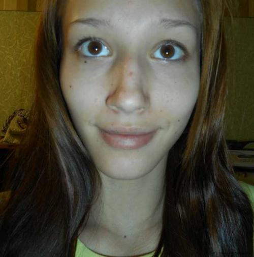 Маскирующий карандаш от прыщей. Что это такое – карандаш от прыщей? 06 Маскирующий карандаш от прыщей. Что это такое – карандаш от прыщей? 06