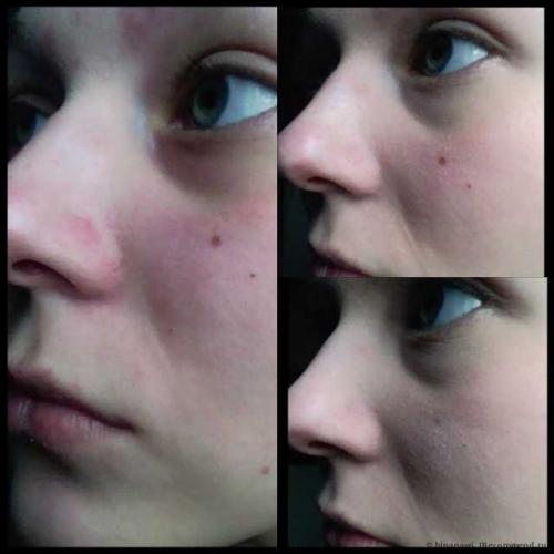 Маскирующий карандаш от прыщей. Что это такое – карандаш от прыщей? 02 Маскирующий карандаш от прыщей. Что это такое – карандаш от прыщей? 02