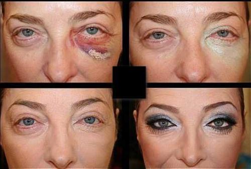 Как пользоваться зеленым консилером. Зачем нужен зеленый консилер? 10 Как пользоваться зеленым консилером. Зачем нужен зеленый консилер? 10