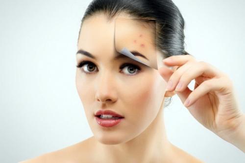 Как убрать черные точки на носу в домашних условиях — быстро и эффективно 05 Как убрать черные точки на носу в домашних условиях — быстро и эффективно 05