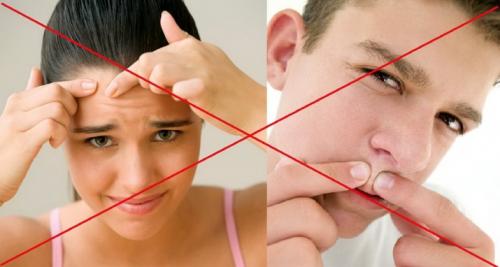 Как убрать черные точки на носу в домашних условиях — быстро и эффективно 06 Как убрать черные точки на носу в домашних условиях — быстро и эффективно 06