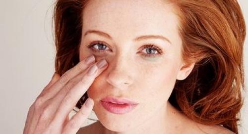 Зеленые круги под глазами. Tpk eti Lady