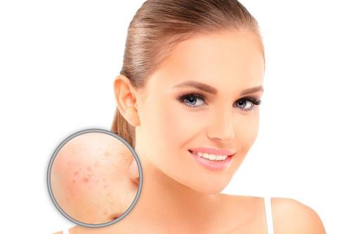 Жирная кожа лица причины. Признаки и причины жирной кожи лица