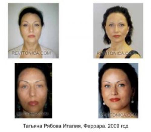 Эффективная гимнастика для лица. Виды гимнастики для лица