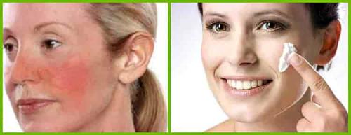 Как помочь сухой коже лица. Причины сухой кожи лица