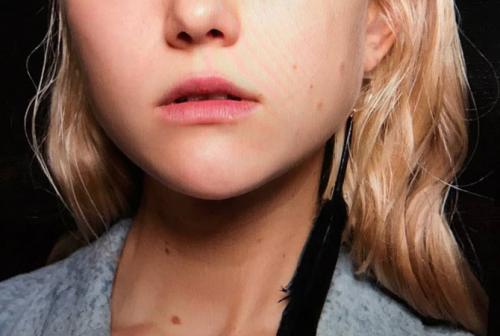 Как убрать черные точки глубокие. Как убрать черные точки: глубокая очистка 05