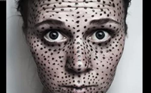 Как убрать черные точки с лица. Способы борьбы с угрями