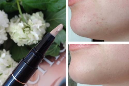 Консилер от прыщей, какой выбрать. Корректор от прыщей: как использовать и какой выбрать? 05 Консилер от прыщей, какой выбрать. Корректор от прыщей: как использовать и какой выбрать? 05