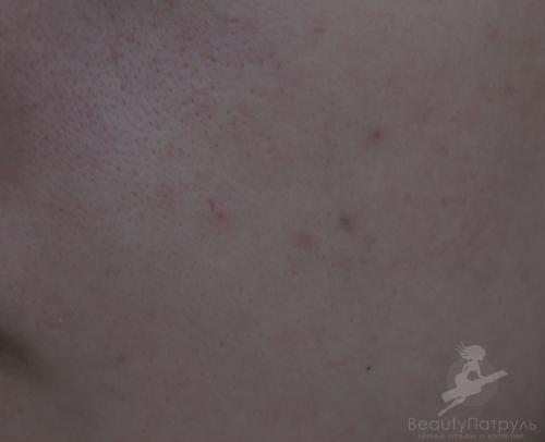 Как использовать зеленый консилер. Цвета консилеров: какой для чего используется 10 Как использовать зеленый консилер. Цвета консилеров: какой для чего используется 10