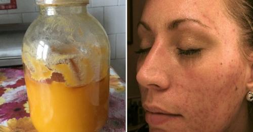 Пилинг лица дома с медом. Пилинг мёдом