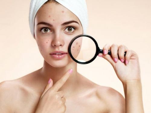 Забитые поры на лице, как избавиться. Причины появления комедонов