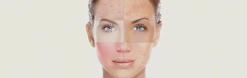 Bha кислоты список. Азбука красоты: BHA – кислоты