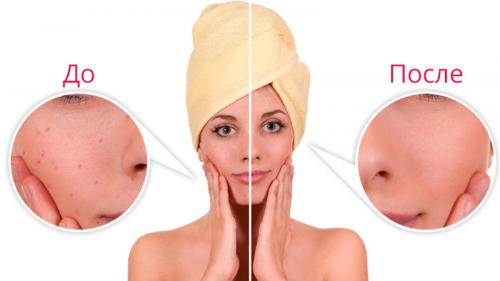 Ана кислоты, как читается. ЧТО ТАКОЕ АЛЬФА-ГИДРОКСИКИСЛОТЫ?