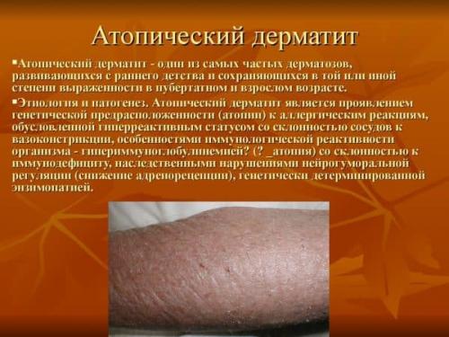 Каких витаминов не хватает при сухости кожи. Возможные заболевания