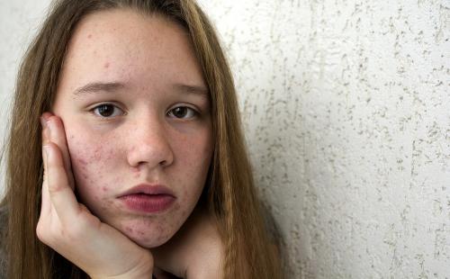 Этапы ухода за комбинированной кожей. 6 основных этапов ухода за комбинированным типом кожи лица