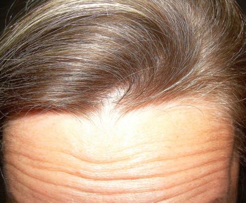 Горизонтальная морщина на переносице физиогномика. Физиогномика: что означают морщины на переносице