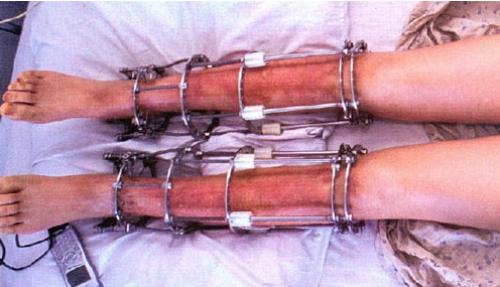 Таблетки для роста. Препараты для увеличения роста