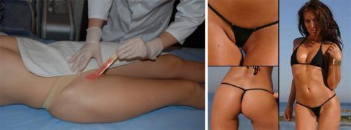 Как сделать эпиляцию в интимной зоне в домашних условиях. Как делают депиляцию в интимных местах